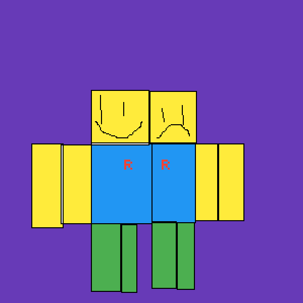 conjoined twins